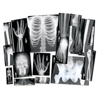 Radiographies humaines - lot de 18 Radiographies humaines - lot de 18