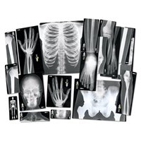 Human X-Rays - set of 18